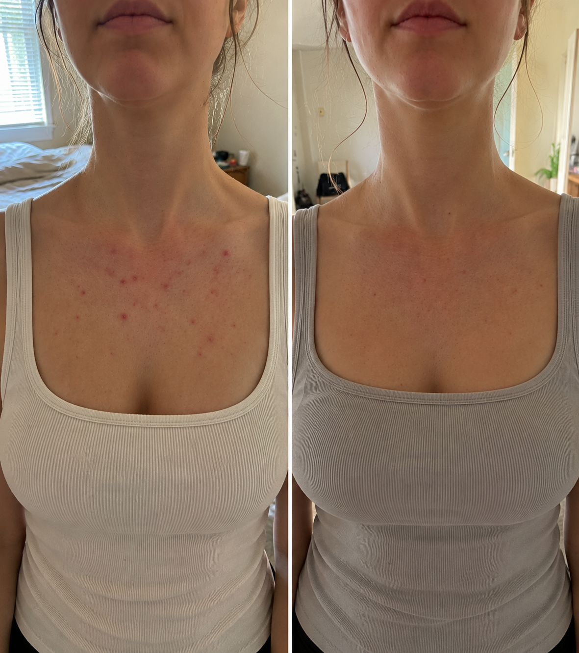 Back & Body Blemish Mist